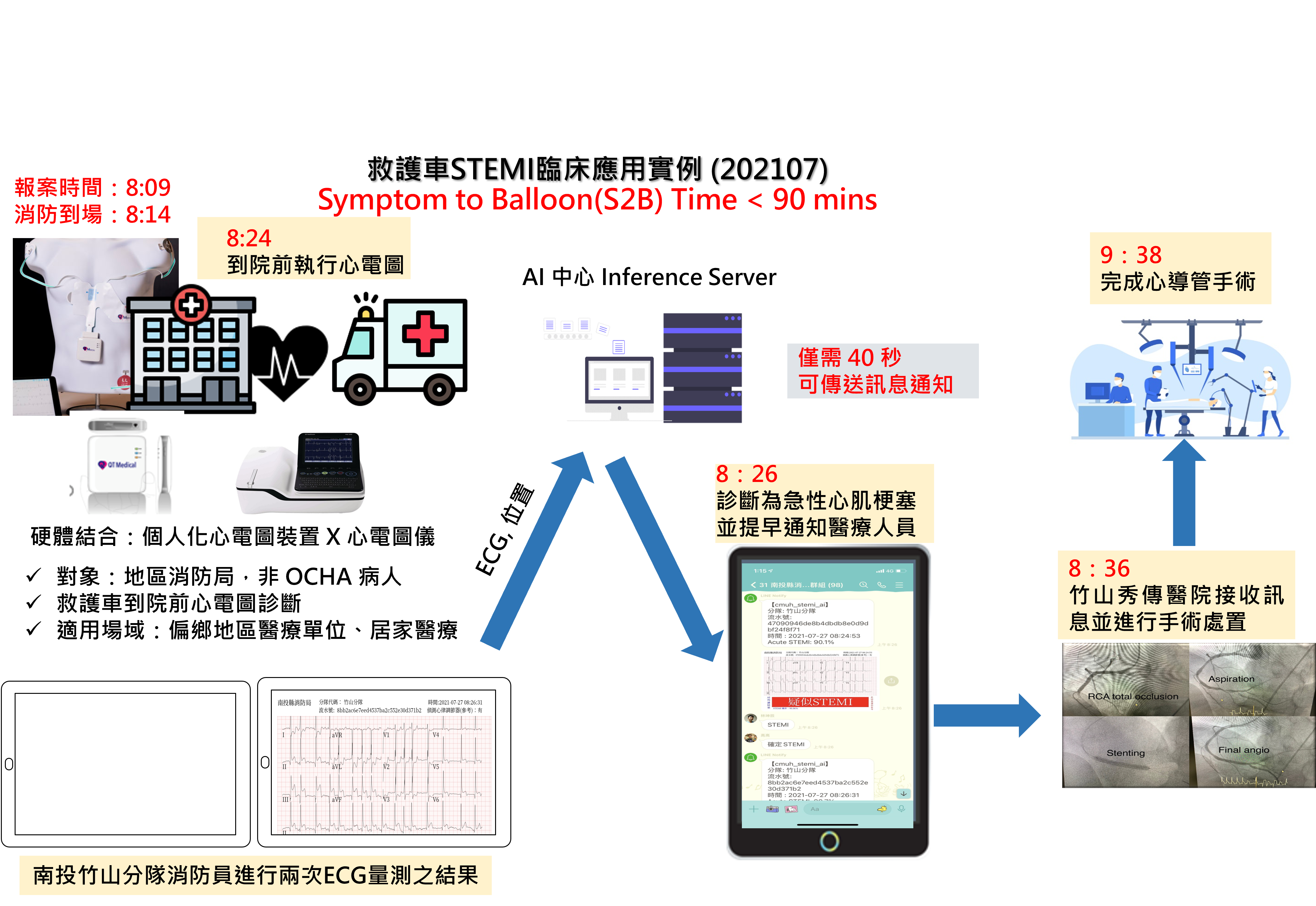 STEMI流程圖.png